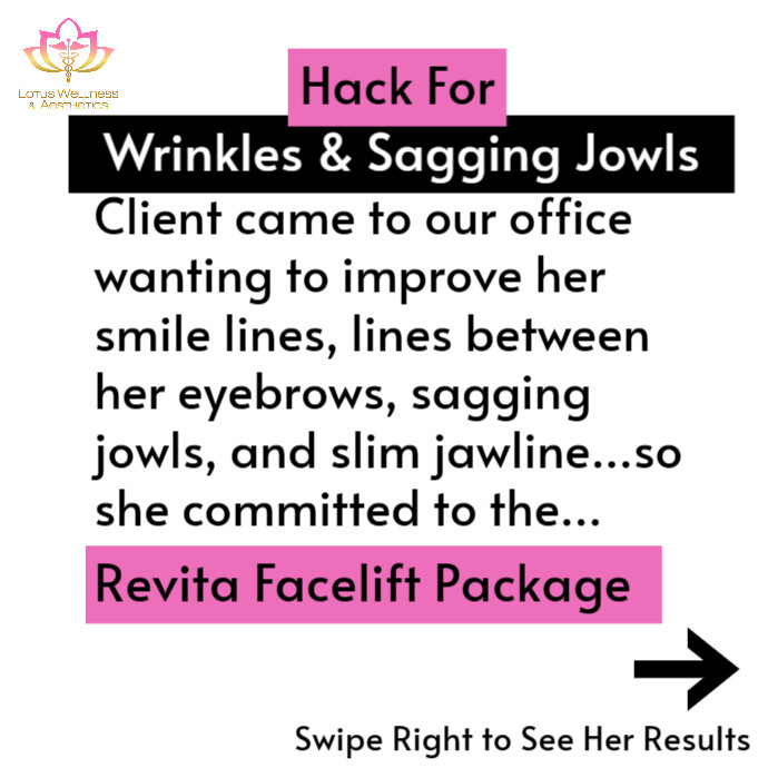 Results Cover Photo | PosterMyWall