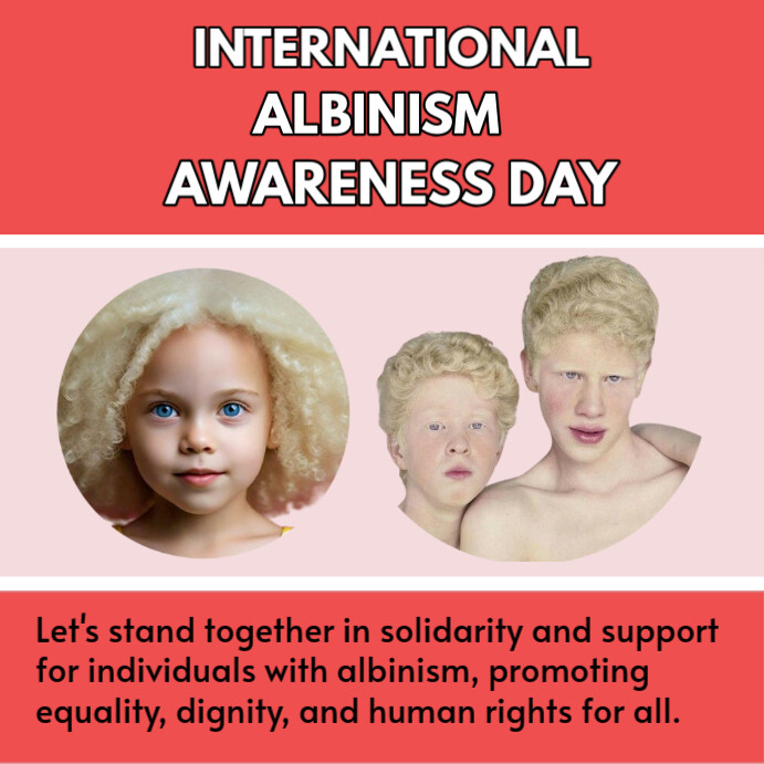 Aqua International Albinism Awareness Day Instagram Post เทมเพลต ...