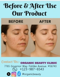 Aqua List-based Before & After Face Product Flyer (us Letter) template