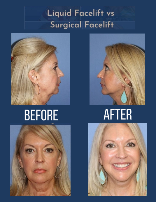 Before & After challenge flyer template
