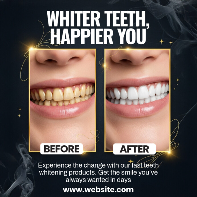 Before and After Dental Template สี่เหลี่ยมจัตุรัส (1:1)