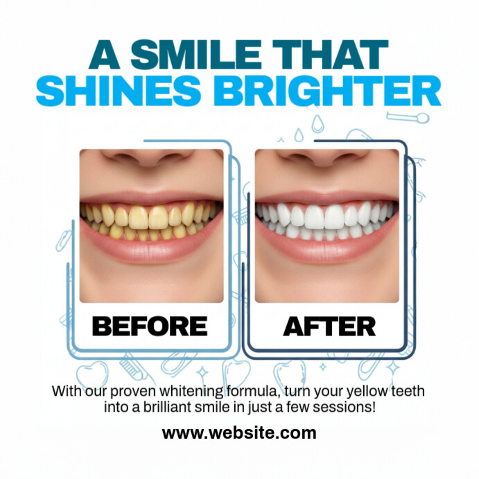 Before and After Dental Template Instagram Post