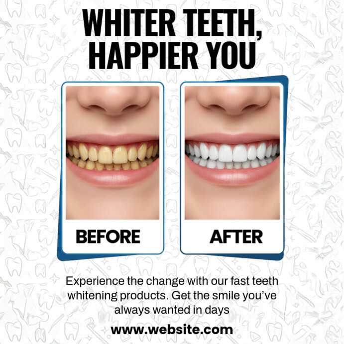 Before and After Dental Template สี่เหลี่ยมจัตุรัส (1:1)