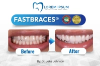 Before and After Label template