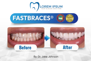 Before and After Etykieta template