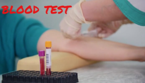 Grey Blood Test Blog overskrift Template