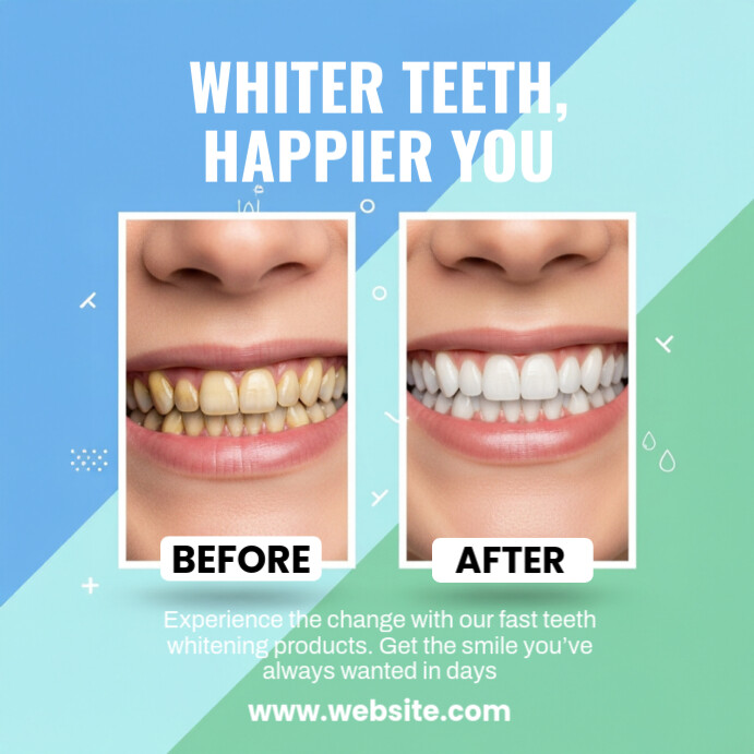 Blue Professional Before And After Dental Template Instagram Post