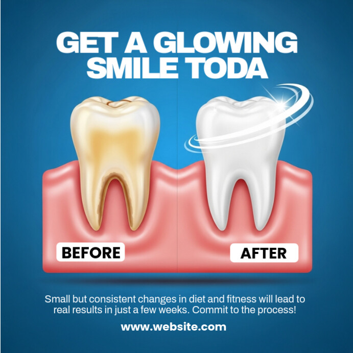 Blue Professional Before And After Dental Template Instagram Post
