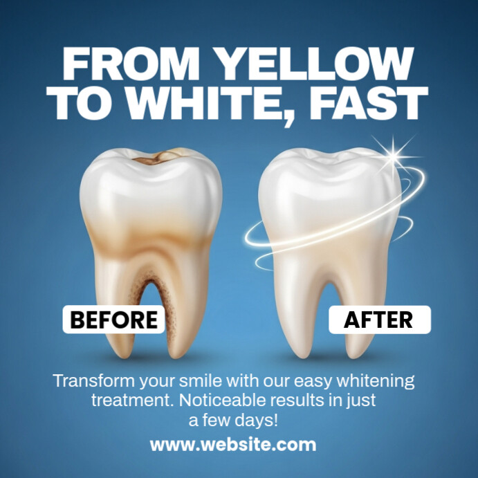 Blue Professional Before And After Dental Template Instagram Post