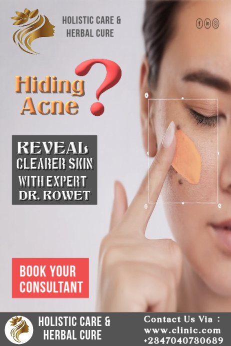 Brown Acne Treatment Poster Template | PosterMyWall