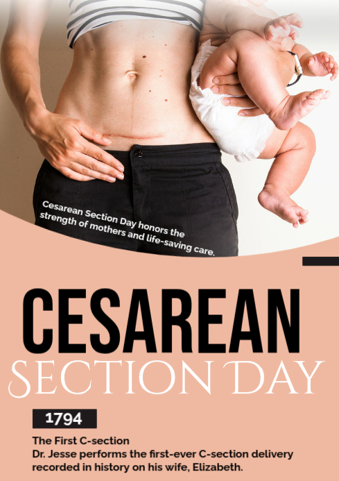 Cesarean Section Day Template | PosterMyWall