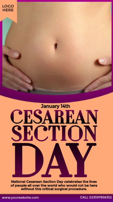 Cesarean Section Day Design Instagram Story template