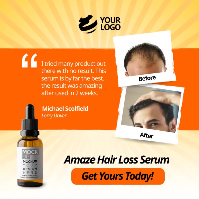 before and after post