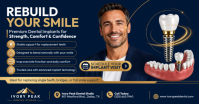 Viola Dental Implants Isithombe Esabiwe ku-Facebook Template