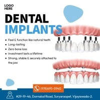 Dental Implants Instagram-bericht template