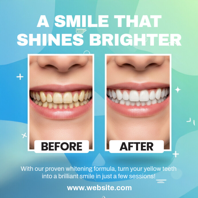 Dental Transformation สี่เหลี่ยมจัตุรัส (1:1) template