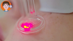 dermatology YouTube-miniature template