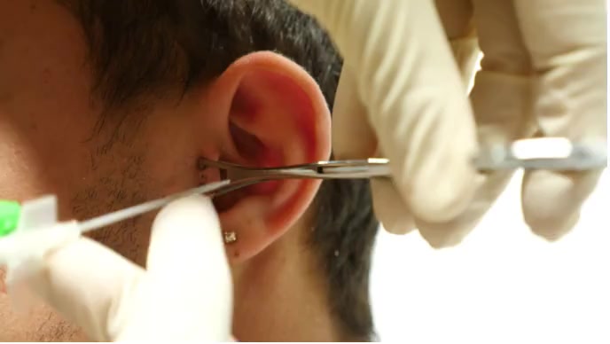 Ear doctor Treatment Template | PosterMyWall