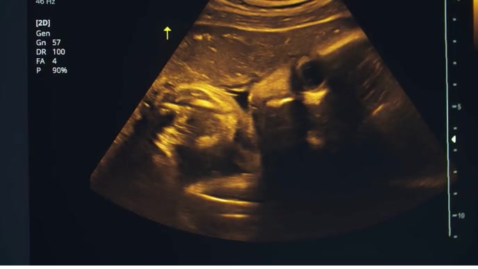 Medical ultrasound YouTube Thumbnail template
