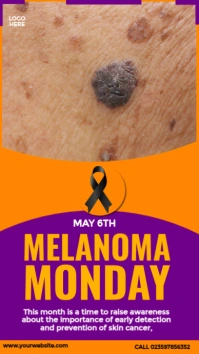 Melanoma Monday Design Instagram-verhaal template