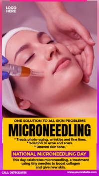 National Microneedling Day Template Instagram Story