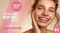 Pastel Gradient Dental Braces Ad Template Affichage numérique (16:9)