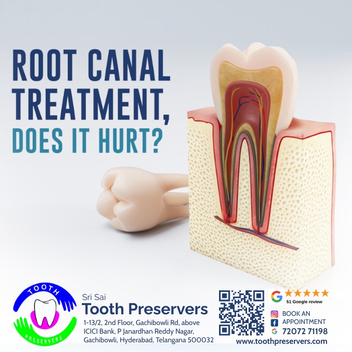 Copy of Root canal (2) PosterMyWall