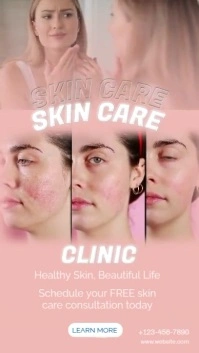 Skincare Clinic Flyer – Before and After Treatment Promo Design Instagram Story template