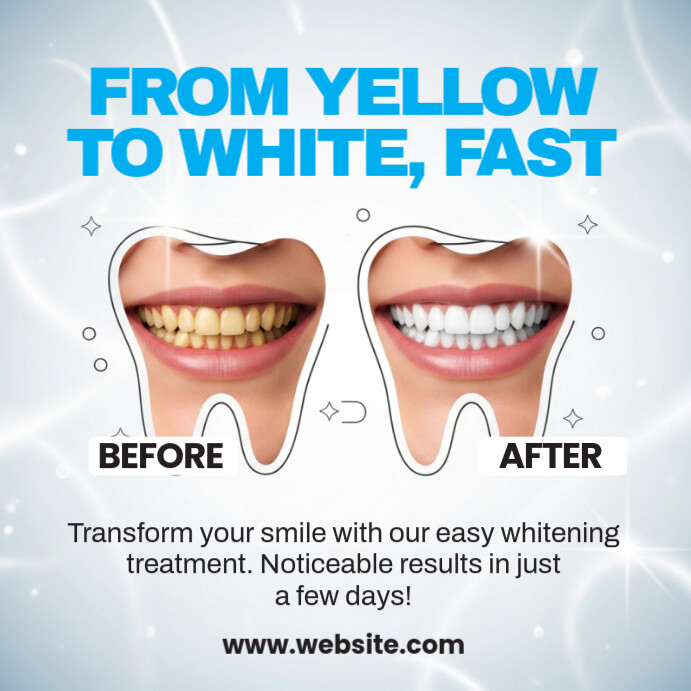 Teeth Whitening Results สี่เหลี่ยมจัตุรัส (1:1) template