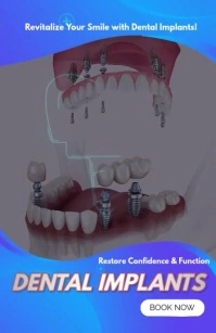 Tooth Implants ad แทบลอยด์ template