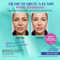 Botox & Dermal Fillers Medical Spa Square Video Template Quadrato (1:1)