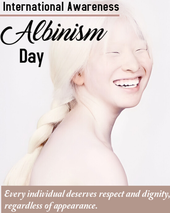 White Modern & Minimal Albinism Day Instagram Portrait Template ...