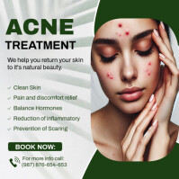 White Professional Acne Treatment Template Design Instagram Post