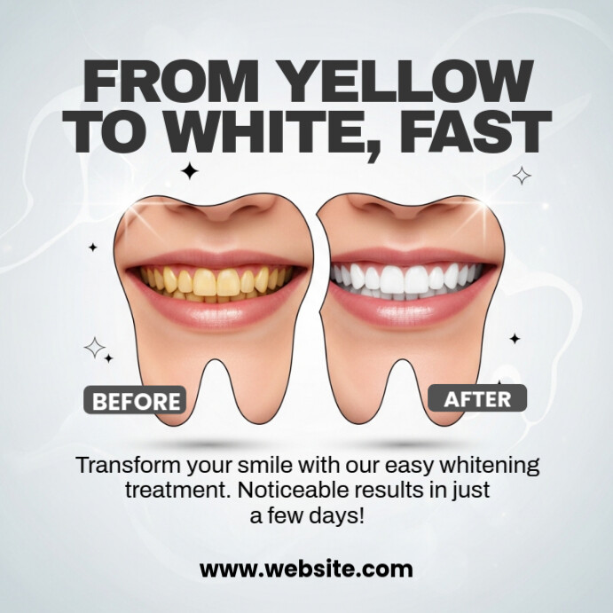 White Professional Before And After Dental Template Instagram Post