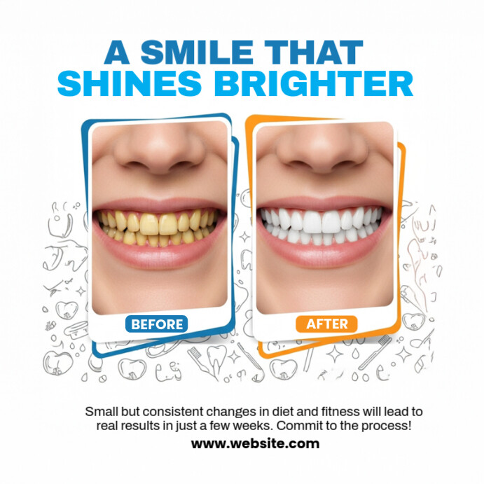 White Professional Before And After Dental Template Square (1:1)
