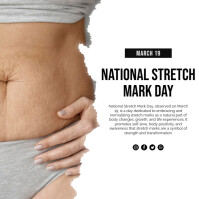 White Professional National Stretch Mark Day Instagram Post Instagram-opslag template