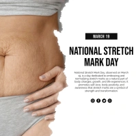 White Professional National Stretch Mark Day Instagram Post template
