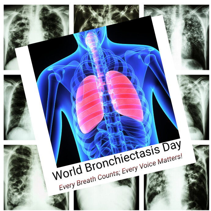 World Bronchiectasis Day Instagram Post template